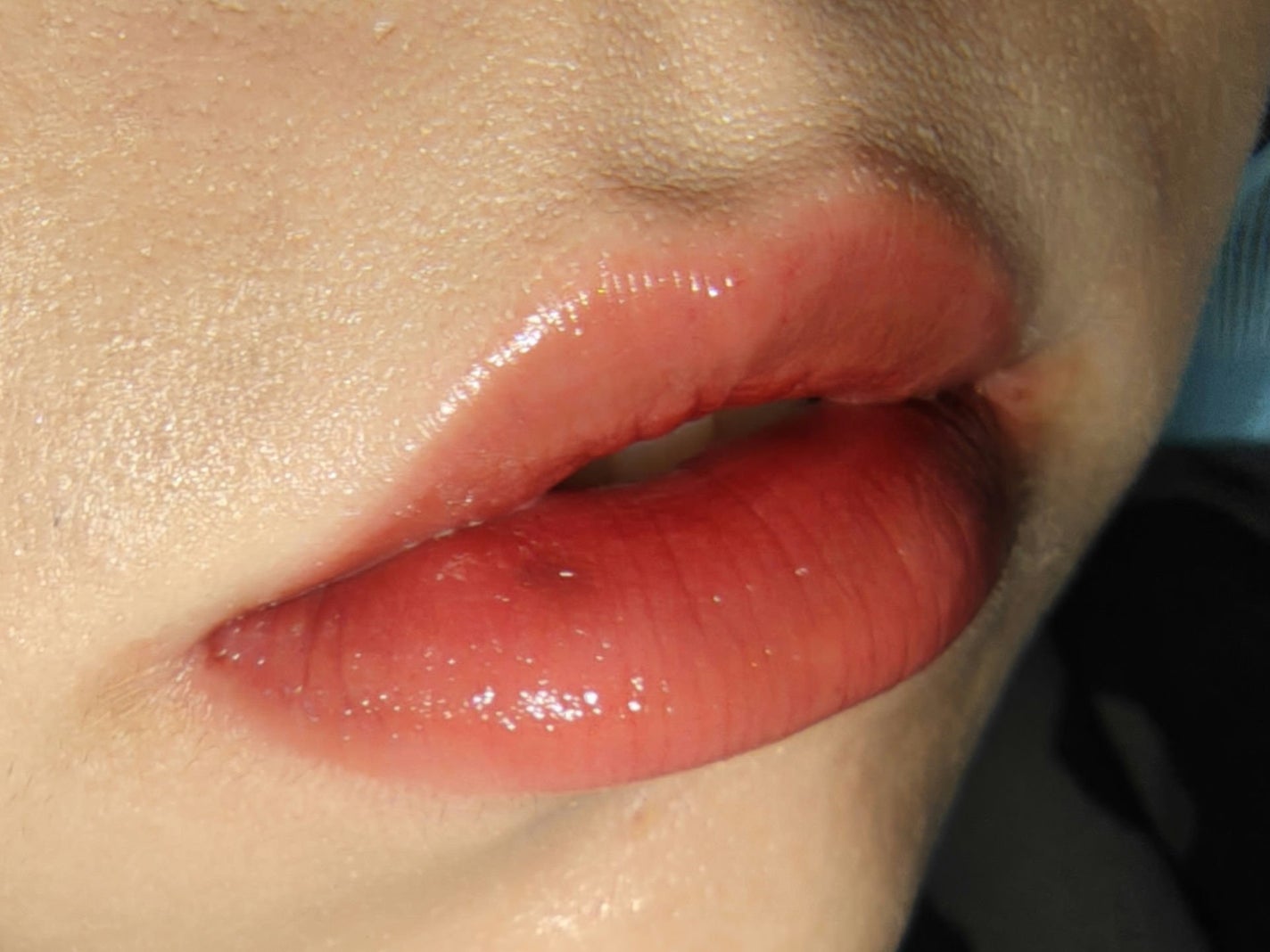 チーク ポップ/CLINIQUE/パウダーチークを使ったクチコミ(5枚目)