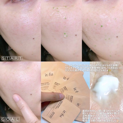 グリーンニードル アンプル/itfu/美容液を使ったクチコミ(4枚目)