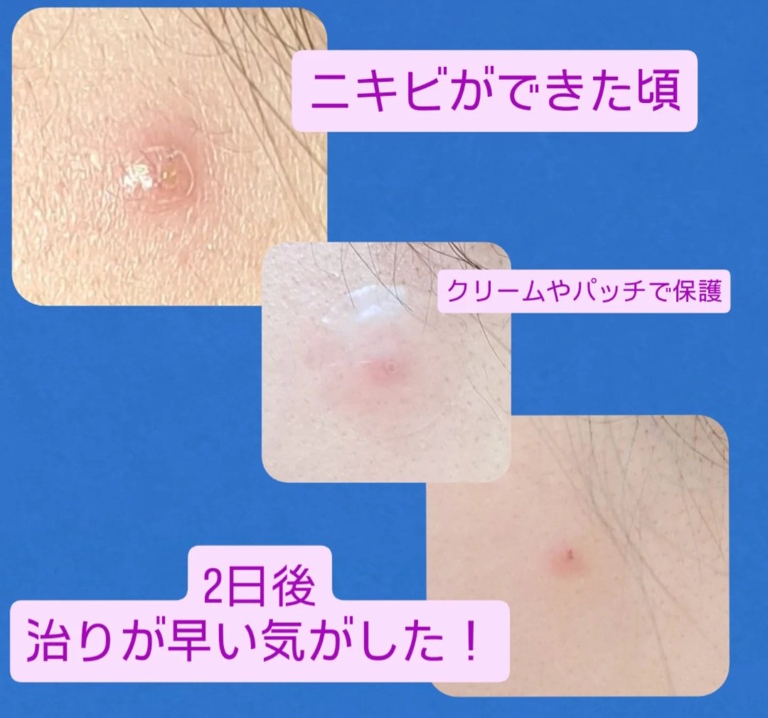 ガーリックリードルショット ジェルクリーム/VT/フェイスクリームを使ったクチコミ（2枚目）