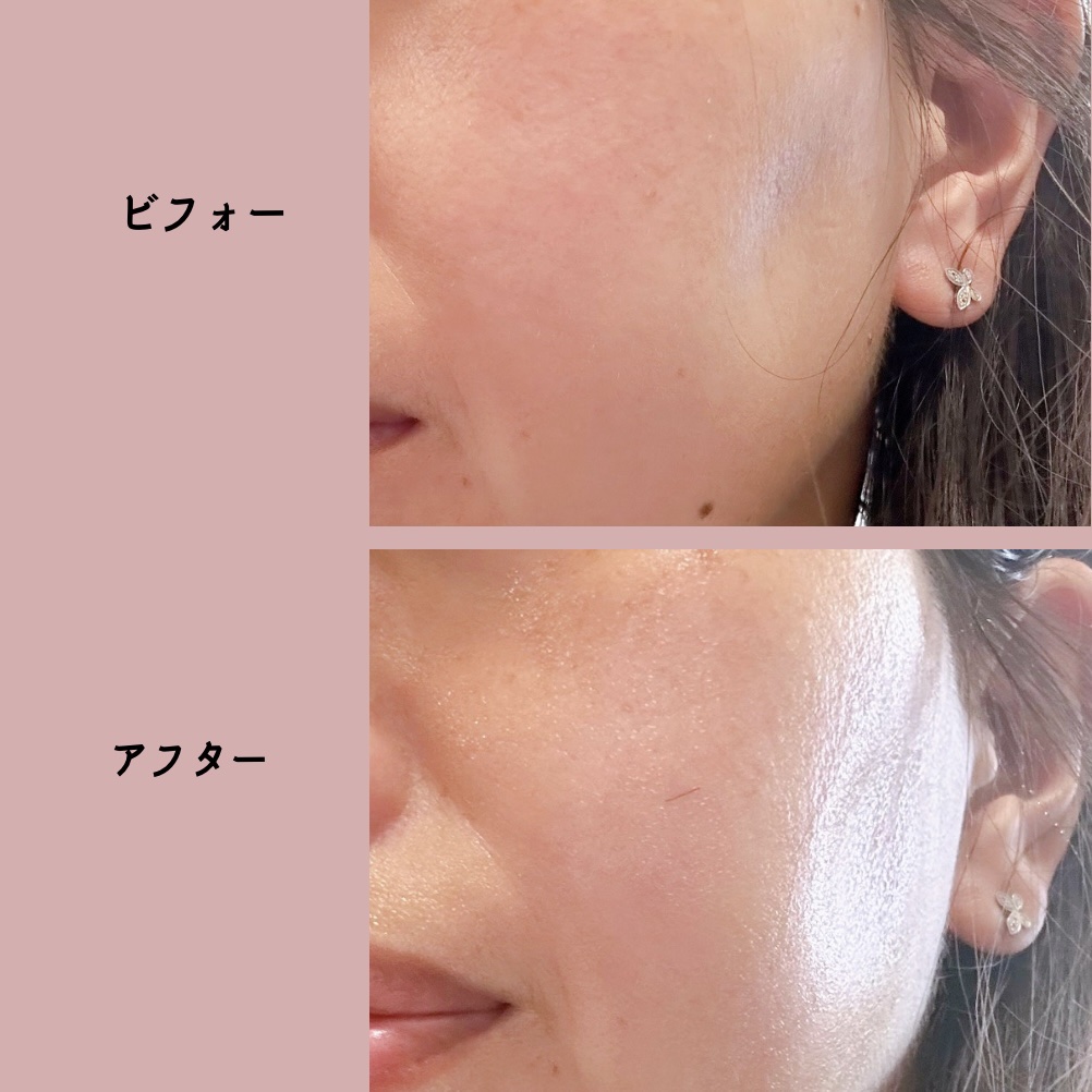 C×AZ ダーマインショット200/ESIENCE/美容液を使ったクチコミ（3枚目）