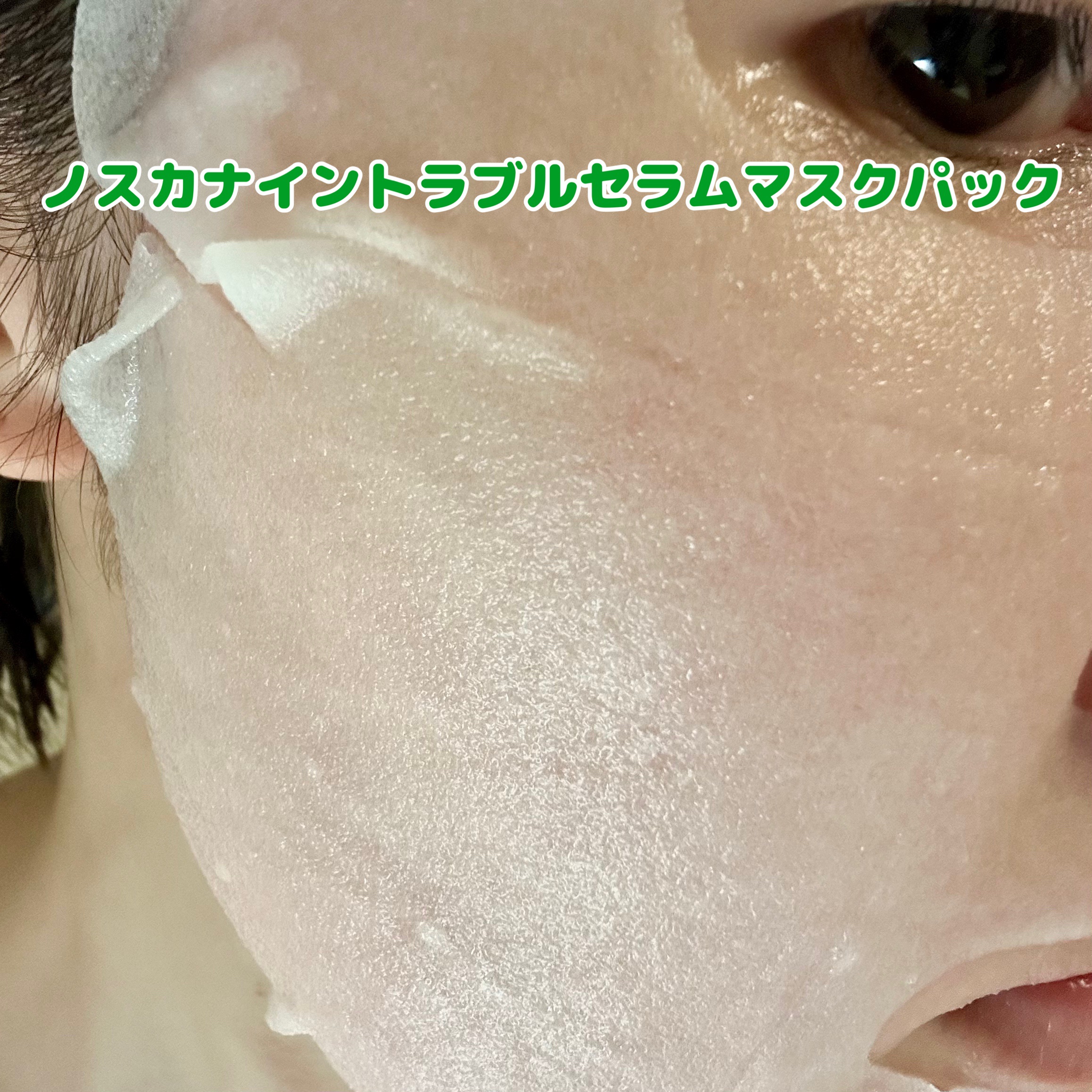 ノスカナイン トラブル セラム/FATION/美容液を使ったクチコミ（3枚目）