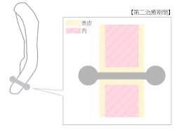 みたらし on LIPS 「用意するもの・キューテンとかで買った激安ニードル・消毒液・キシ..」(3枚目)