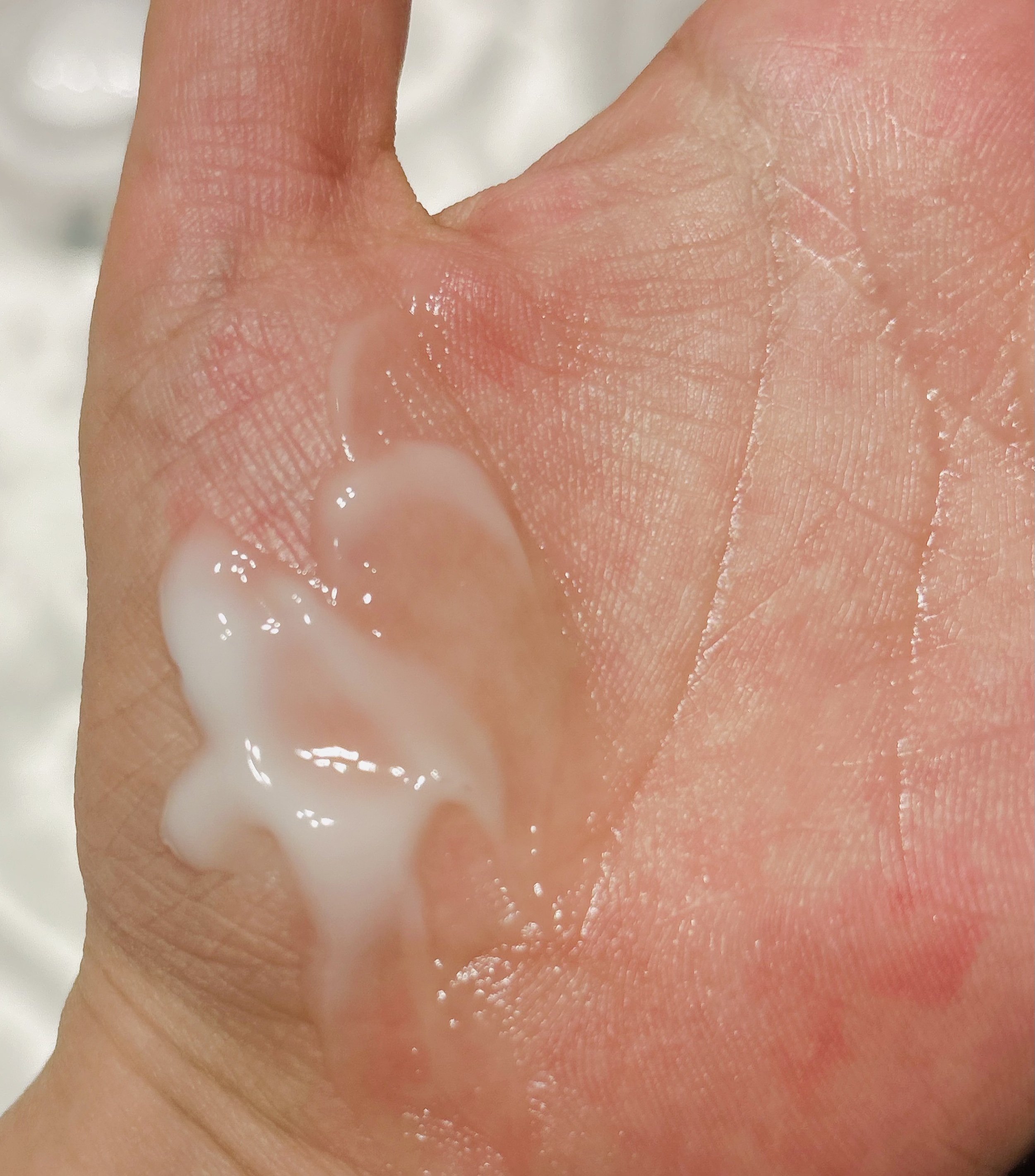 ダーマジェンシー ゼロカ81 クリーム/DERMAGENCY/フェイスクリームを使ったクチコミ（3枚目）