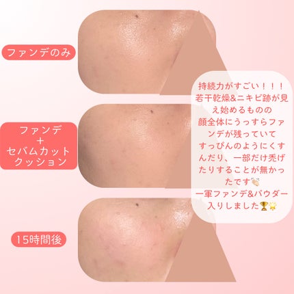 ããŒãã«ãããã«ããŒã¯ãã·ã§ã³/espoir/ã¯ãã·ã§ã³ãã¡ã³ããŒã·ã§ã³ã䜿ã£ãã¯ãã³ãïŒ4æç®ïŒ