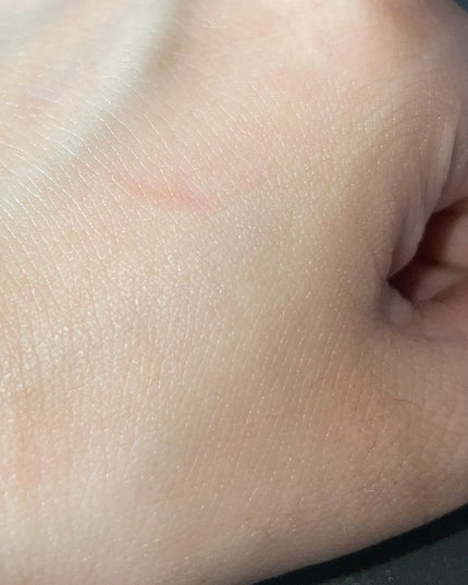 グルタチオンラディアンスセラム/SKIN&LAB/美容液を使ったクチコミ(5枚目)