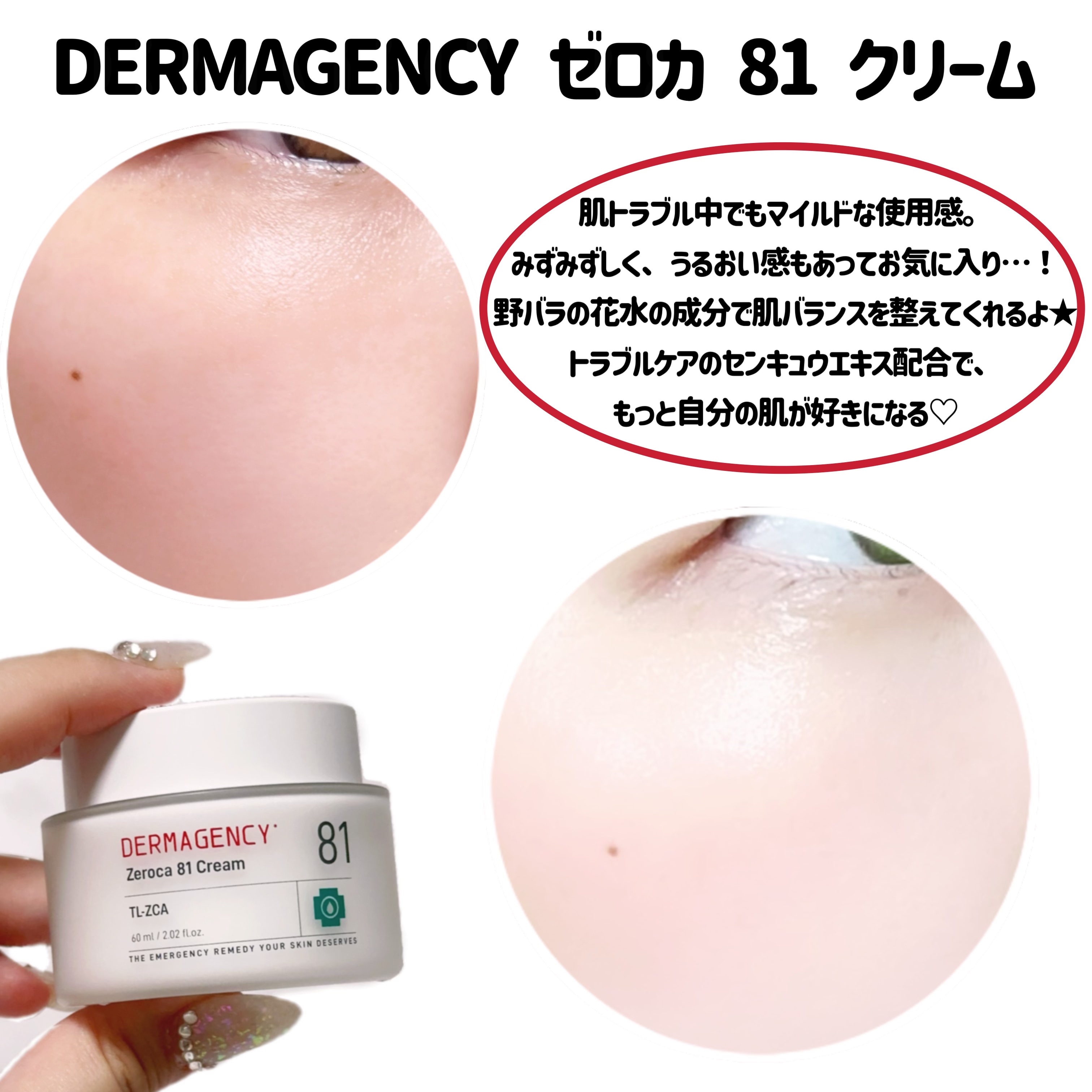 ダーマジェンシー ゼロカ81 クリーム/DERMAGENCY/フェイスクリームを使ったクチコミ（3枚目）