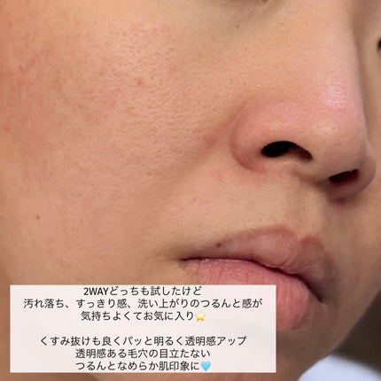 ããã¢ïŒïŒ·ïŒ¡ïŒ¹çŸå®¹æŽé¡ AC/ããã¢/æŽé¡ãã©ãŒã ã䜿ã£ãã¯ãã³ãïŒ5æç®ïŒ