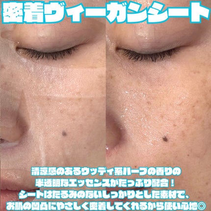 マデカソサイド ブレミッシュパッド/MEDIHEAL/トナーパッドを使ったクチコミ(3枚目)