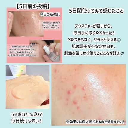 ダーマジェンシー ゼロカ81 セラム/DERMAGENCY/美容液を使ったクチコミ(2枚目)