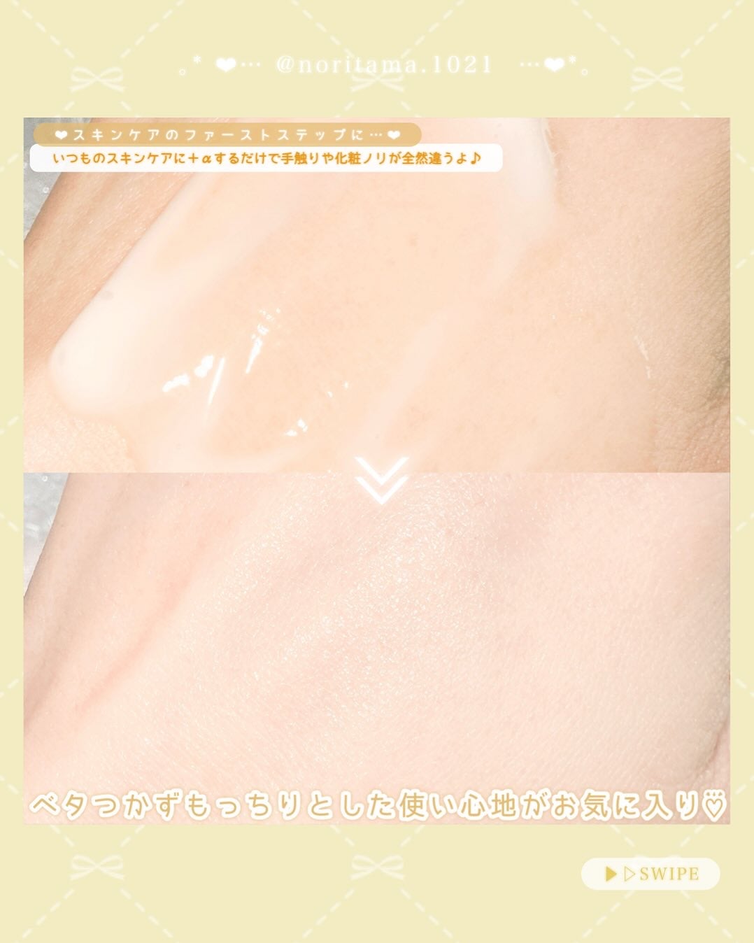 レチララ 美容液/ネイチャーリパブリック/美容液を使ったクチコミ(4枚目)