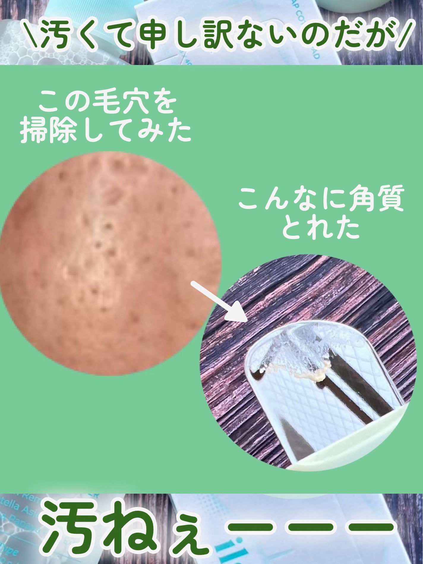 ディープクリーンマスター/ilso/その他スキンケアグッズを使ったクチコミ(7枚目)