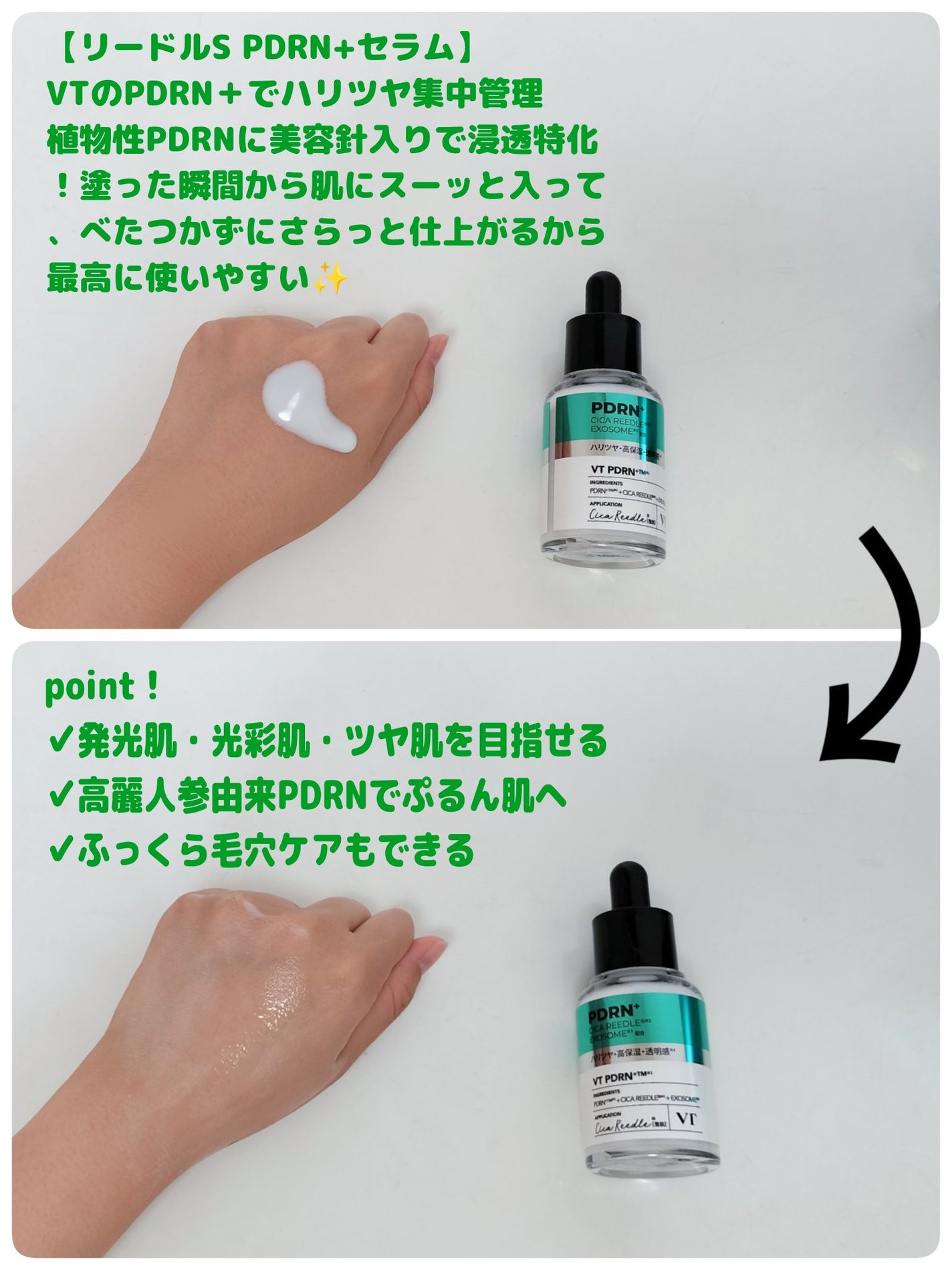 ゆきな on LIPS 「VTリードルSPDRN+セラム&PDRNトナー使ってみてこれエ..」(3枚目)