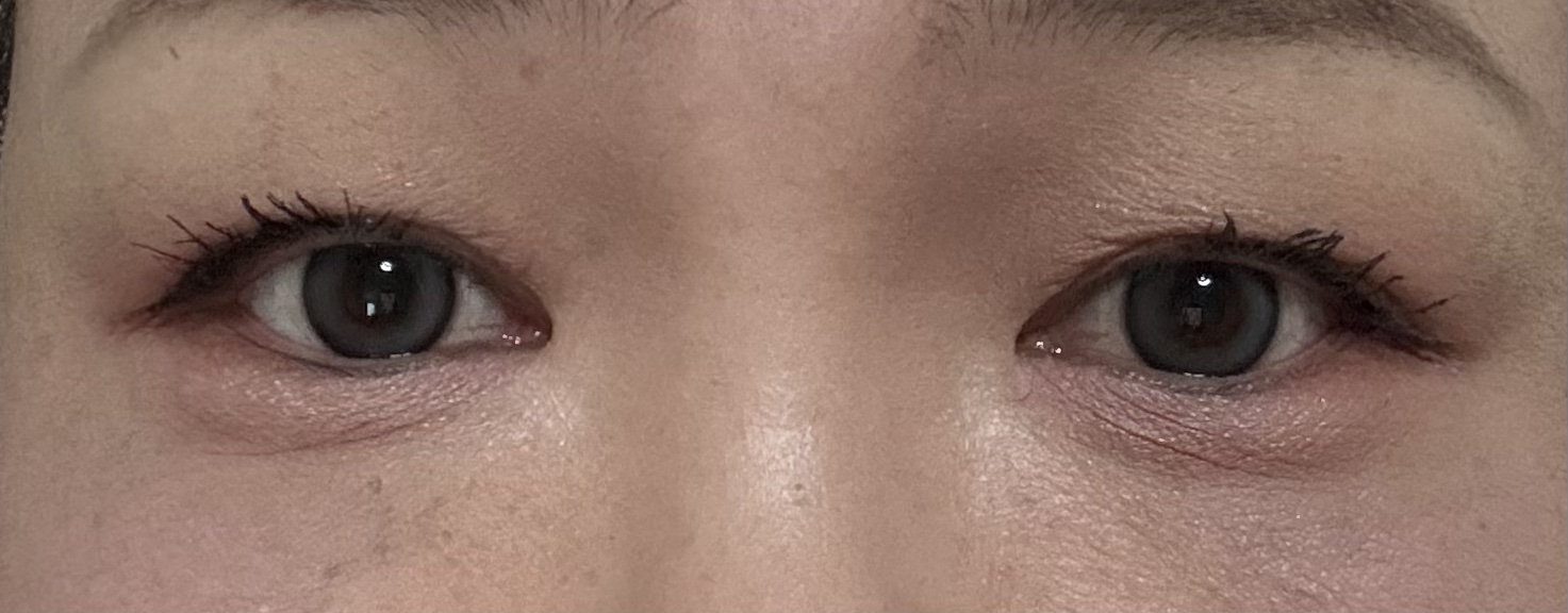 ハトムギ化粧水(ナチュリエ スキンコンディショナー R )/ナチュリエ/化粧水を使ったクチコミ（3枚目）