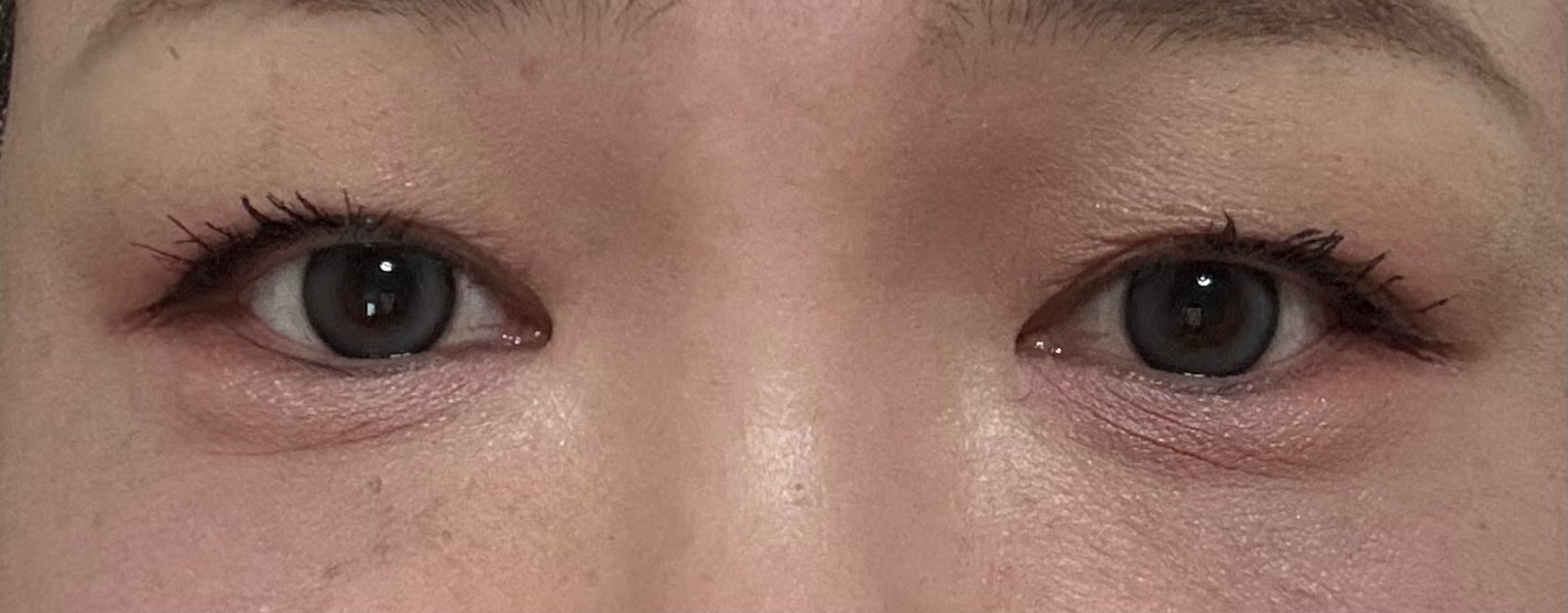 ããã ã®åç²§æ°Ž(ããã¥ãªãš ã¹ãã³ã³ã³ãã£ã·ã§ã㌠R )/ããã¥ãªãš/åç²§æ°Žã䜿ã£ãã¯ãã³ãïŒ3æç®ïŒ