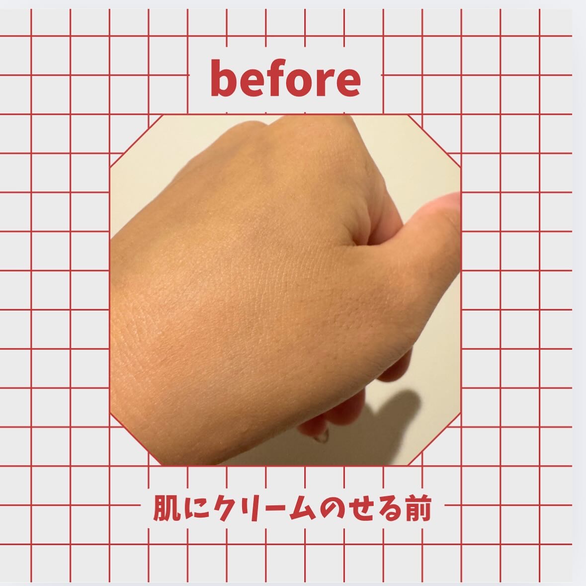 ダーマジェンシー ゼロカ81 クリーム/DERMAGENCY/フェイスクリームを使ったクチコミ（3枚目）