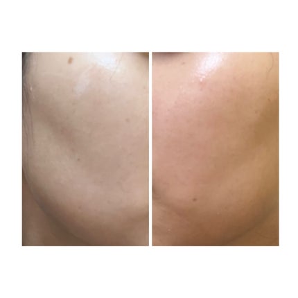 ぽむ on LIPS 「1枚目 2025.8.24エピデュオ 711日目2枚目 202..」(1枚目)