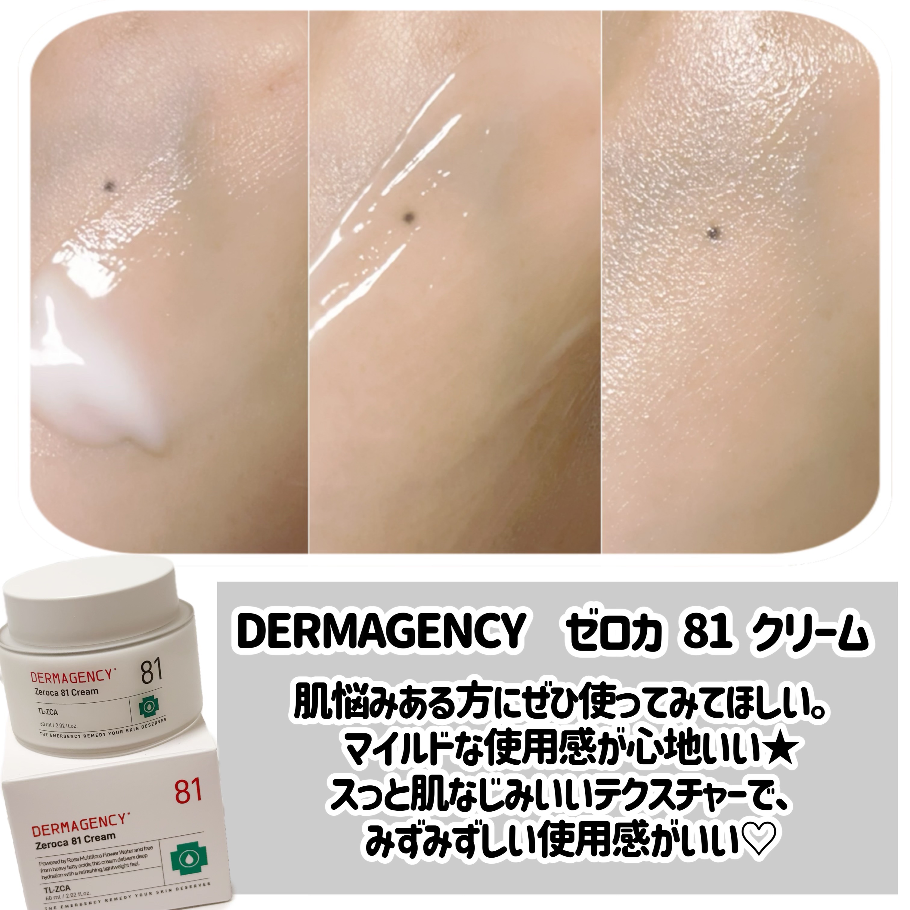 ダーマジェンシー ゼロカ81 クリーム/DERMAGENCY/フェイスクリームを使ったクチコミ（2枚目）