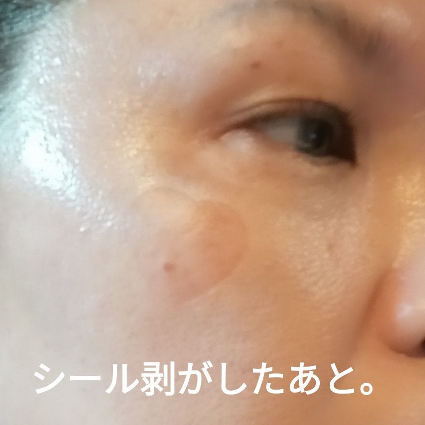 イージーデュー メラB トーニングアンプルクッション/Easydew/クッションファンデーションを使ったクチコミ(5枚目)