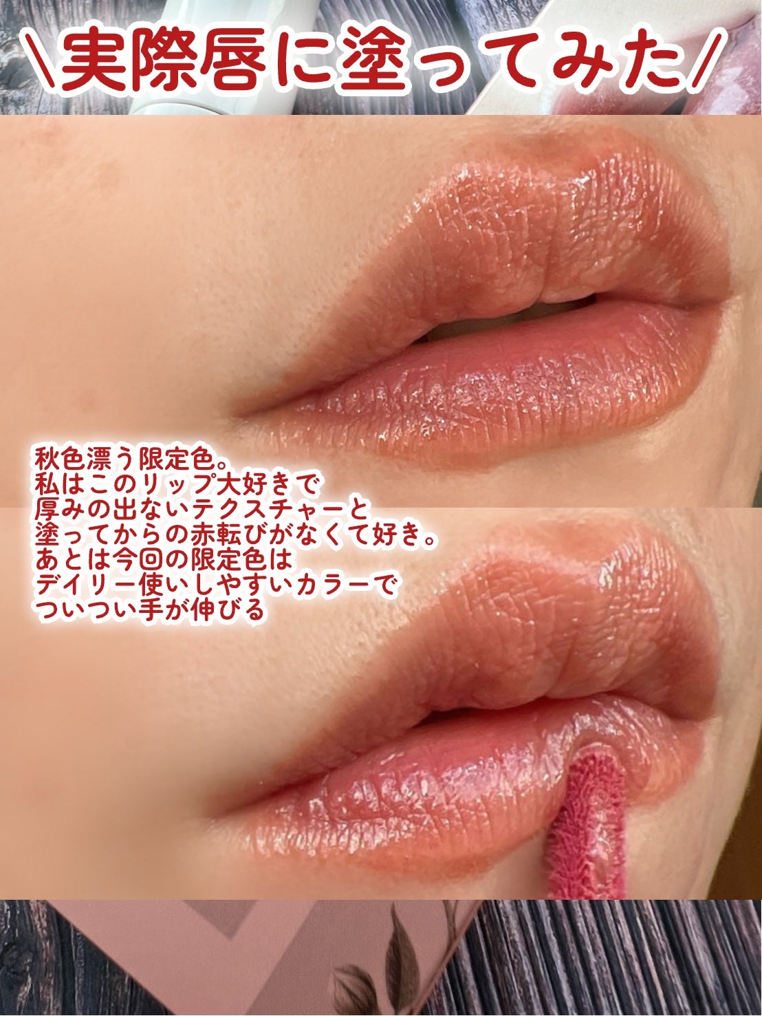 ã¢ãããã¥ãŒããŒããã°ãã€ãªãããã«ã©ãŒããã¯ãã©ã³ããŒ/up2me/ãªãããã©ã³ããŒã䜿ã£ãã¯ãã³ãïŒ4æç®ïŒ