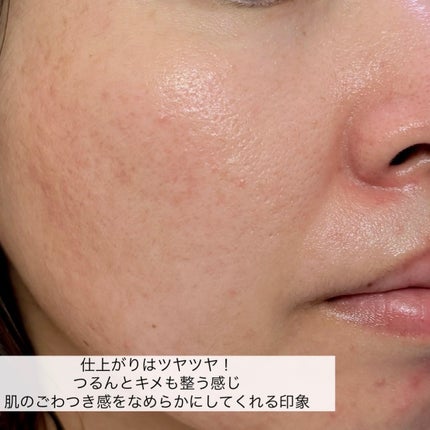 R5ファーミング アンプル/VT/美容液を使ったクチコミ(5枚目)