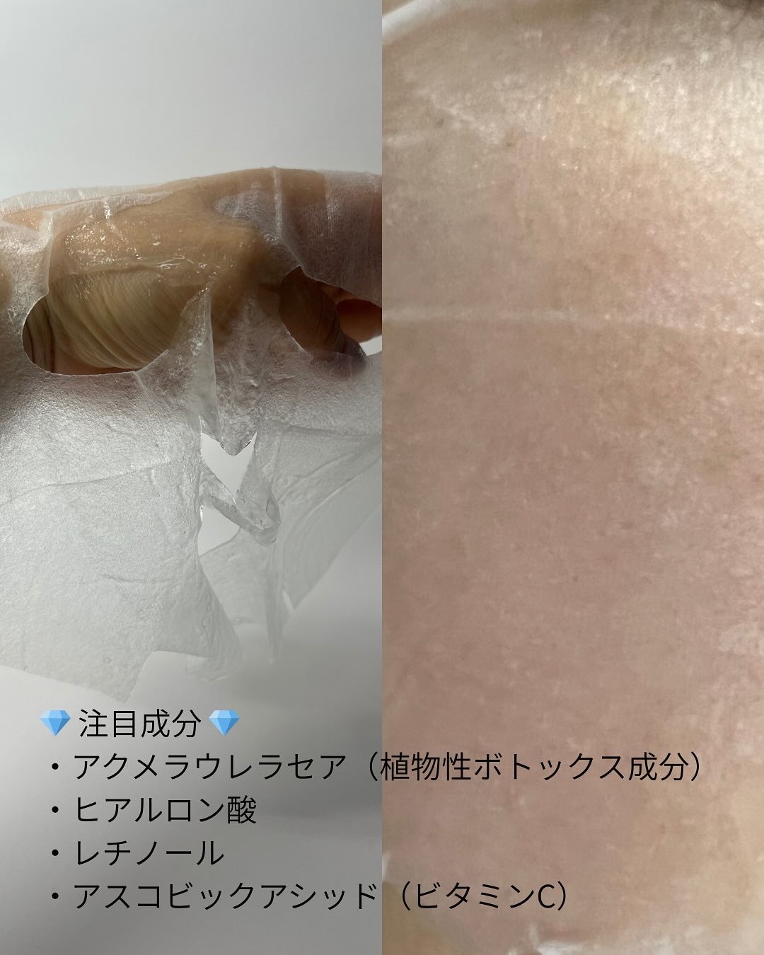 6in1ボリュームアンプルマスク/CHICSKIN/シートマスク・パックを使ったクチコミ(3枚目)