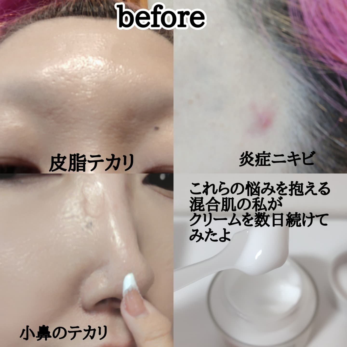 ダーマジェンシー ゼロカ81 クリーム/DERMAGENCY/フェイスクリームを使ったクチコミ（3枚目）