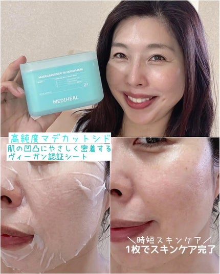 マデカソサイド ブレミッシュパッド/MEDIHEAL/トナーパッドを使ったクチコミ(2枚目)