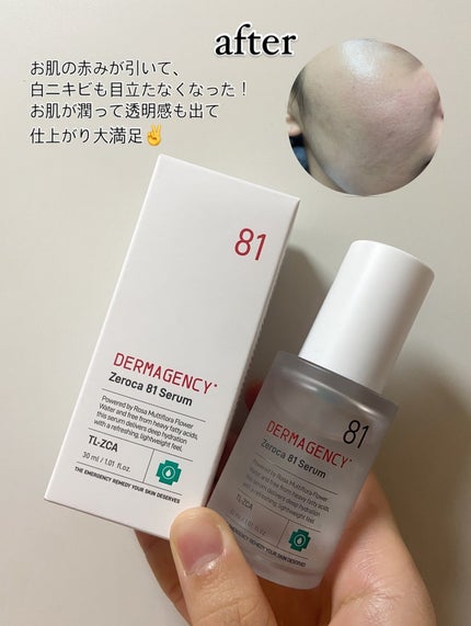 ダーマジェンシー ゼロカ81 セラム/DERMAGENCY/美容液を使ったクチコミ(4枚目)