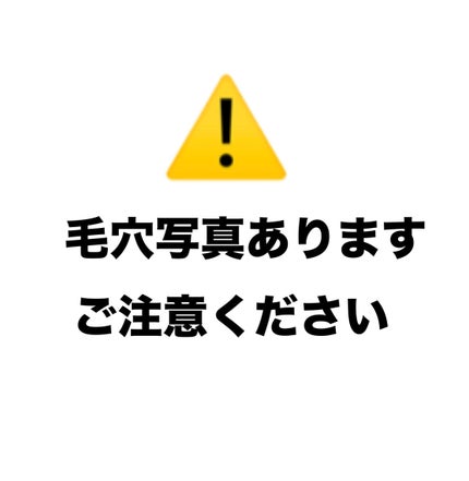アミノ酸あわ洗顔料/Mマークシリーズ/泡洗顔を使ったクチコミ(2枚目)