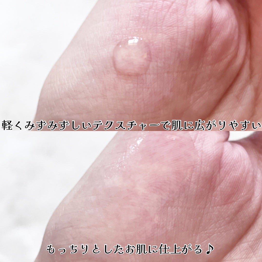 ビタ3セラム/オーズナリー/美容液を使ったクチコミ(3枚目)