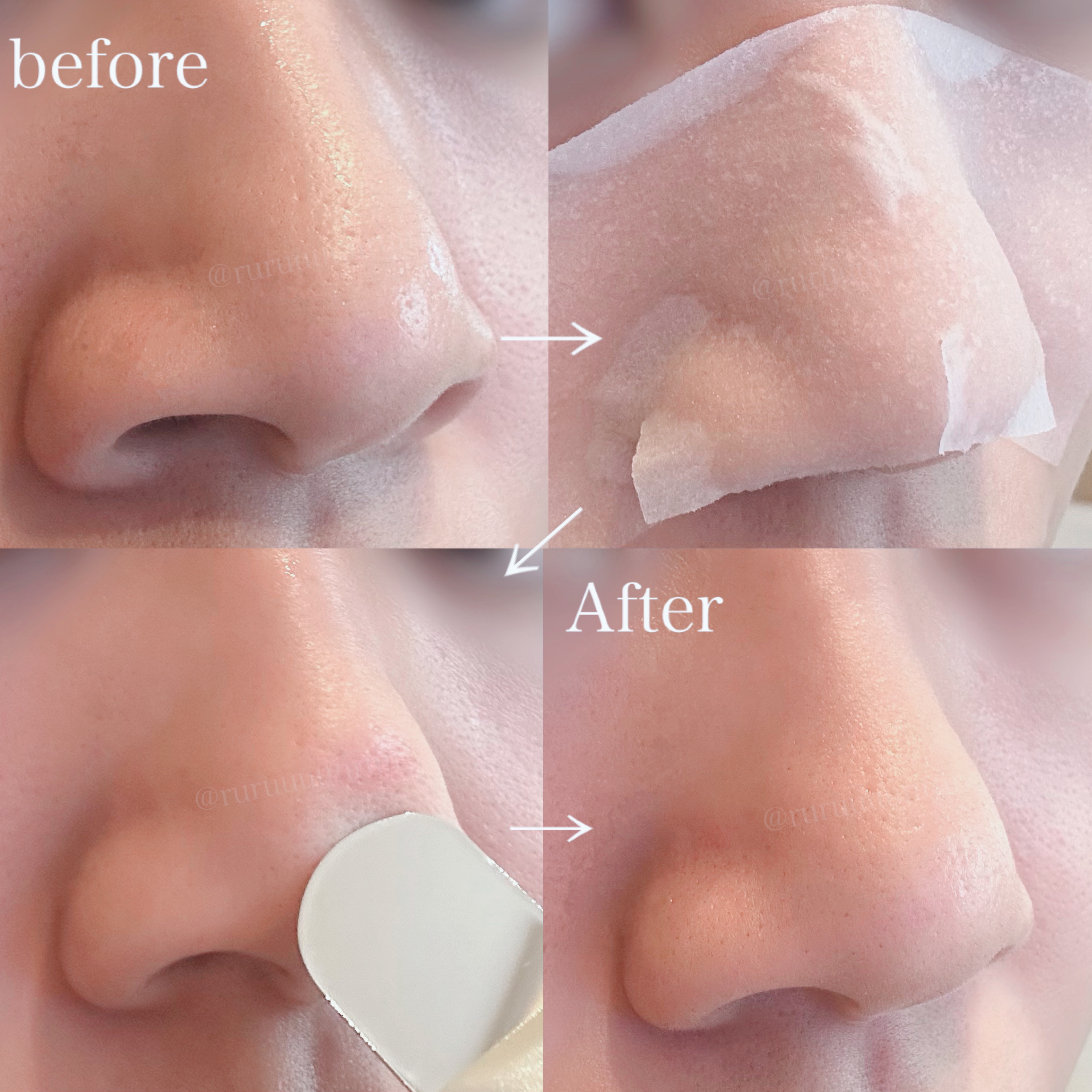 ディープクリーンマスター/ilso/その他スキンケアグッズを使ったクチコミ（3枚目）