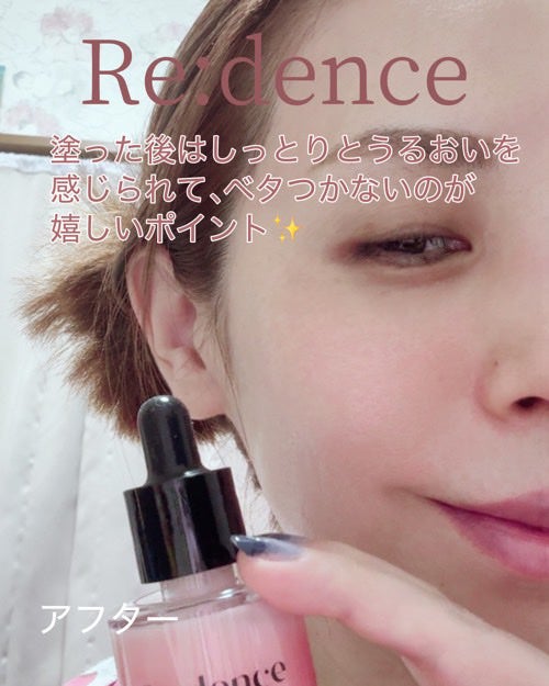 リデンス チェリートーン&スポットコレクターアンプル/redence/美容液を使ったクチコミ(5枚目)