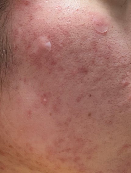 を使ったクチコミ(2枚目)