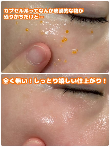 PDRNキューブクリーム/DPPR/フェイスクリームを使ったクチコミ(4枚目)