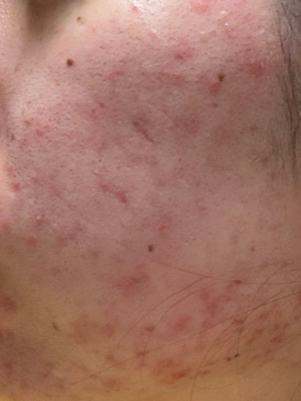 を使ったクチコミ(3枚目)