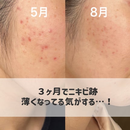 薬用 しみ 集中対策 美容液/メラノCC/美容液を使ったクチコミ(3枚目)