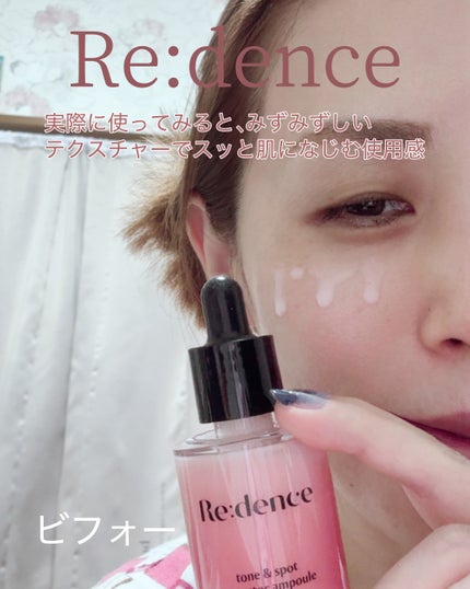 リデンス チェリートーン&スポットコレクターアンプル/redence/美容液を使ったクチコミ(4枚目)