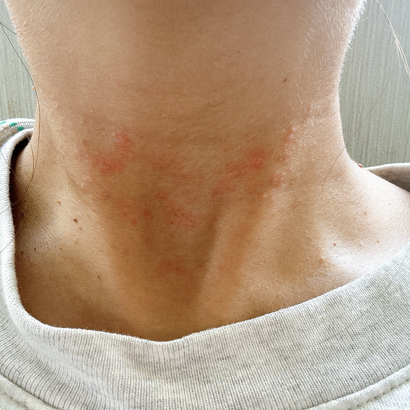 ウオーター/アベンヌ/ミスト状化粧水を使ったクチコミ(4枚目)