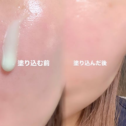 ReDRNエクソソームアンプル/Dr.nineteen/美容液を使ったクチコミ(4枚目)