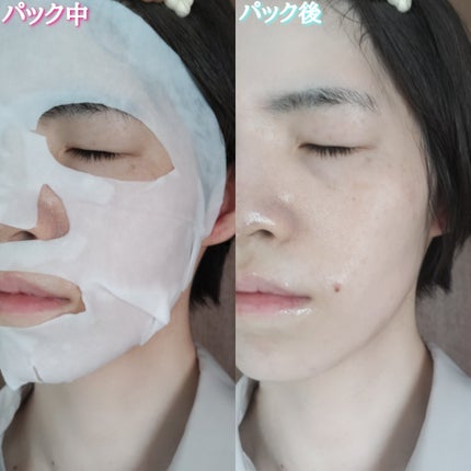 ターンオーバーマスク/REJURAN COSMETICS/シートマスク・パックを使ったクチコミ(6枚目)