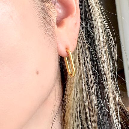 ã¡ããã¿ð on LIPS ããµãŒãžã«ã«ã¹ãã³ã¬ã¹å°éåºå
šåéå±ã¢ã¬ã«ã®ãŒå¯Ÿå¿ã®å®å¿çŽ æâ¡-..ãïŒ4æç®ïŒ