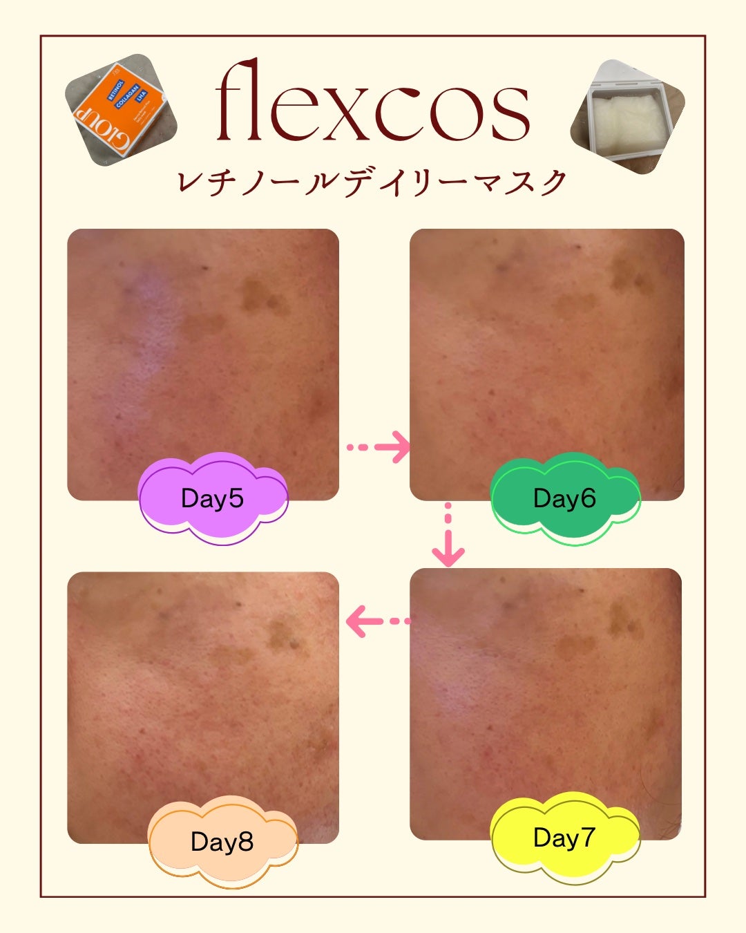 GLOUP DERMA RETINOL PLUS DAILY MASK/flexcos/シートマスク・パックを使ったクチコミ(6枚目)