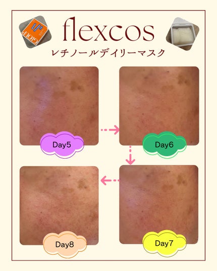 GLOUP DERMA RETINOL PLUS DAILY MASK/flexcos/シートマスク・パックを使ったクチコミ(6枚目)