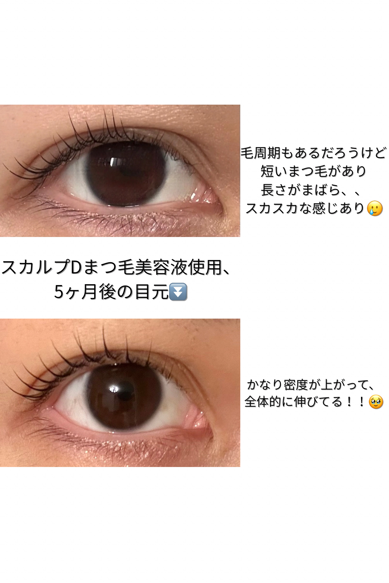 スカルプD アイラッシュセラム プレミアム/アンファー(スカルプD)/まつげ美容液を使ったクチコミ（2枚目）