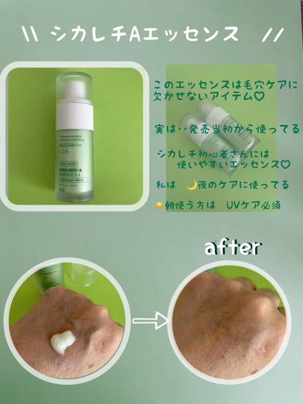シカレチA エッセンス0.1/VT/美容液を使ったクチコミ(7枚目)