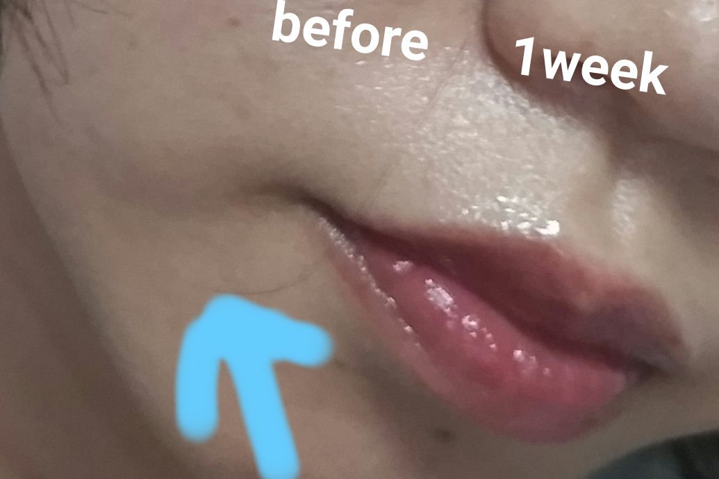 を使ったクチコミ（2枚目）