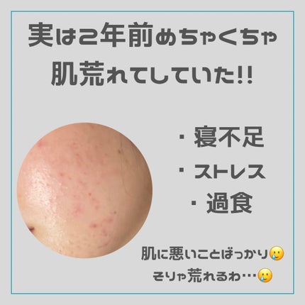 フェイシャリスト  ファーメントパウダーa (酵素洗顔料)/シーボン./洗顔パウダーを使ったクチコミ(2枚目)