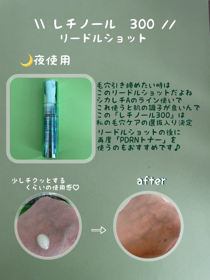 シカレチA エッセンス0.1/VT/美容液を使ったクチコミ(5枚目)