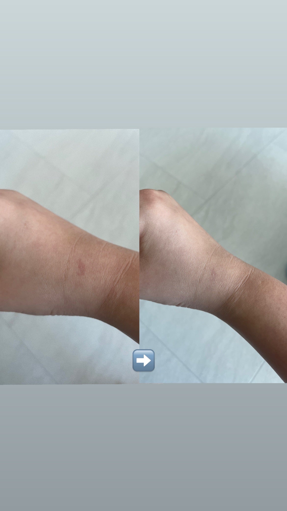 リフレクション スキン グロウ クッション ファンデーション/HERA/クッションファンデーションを使ったクチコミ(3枚目)