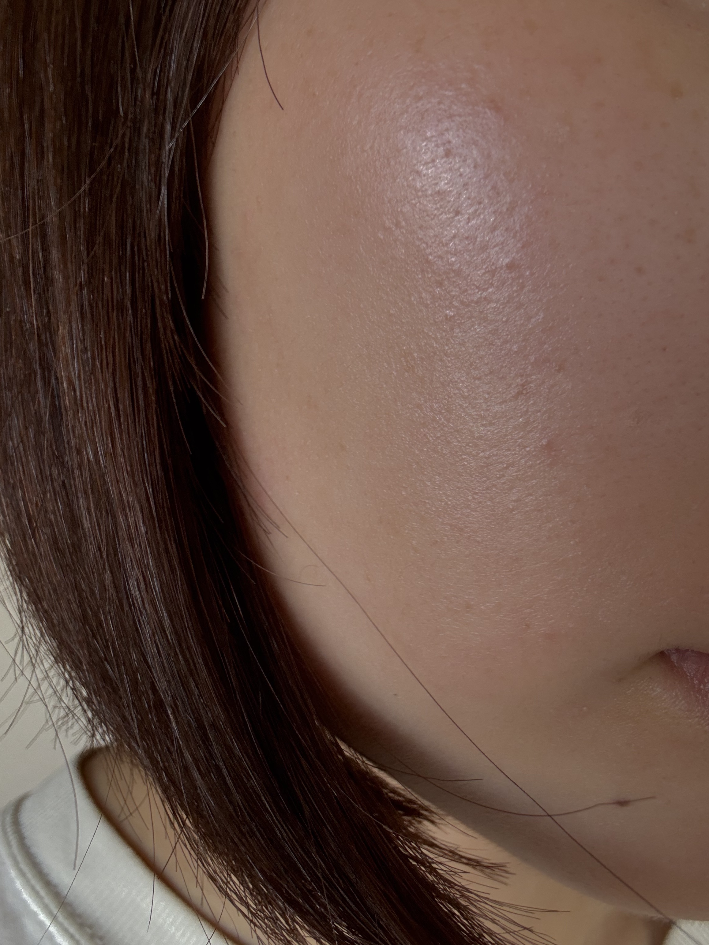 セラミドスキンケア 薬用アクネVCローション/エトヴォス/化粧水を使ったクチコミ（2枚目）